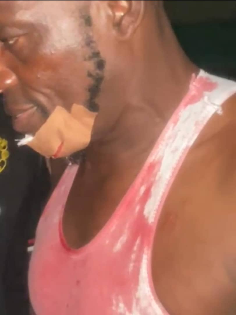 Cover image for How not to kill the NPFL